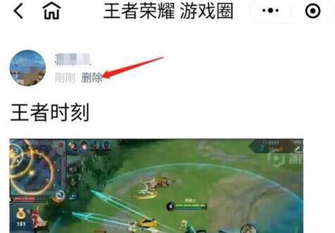 微信里王者榮耀視頻記錄怎么刪除？