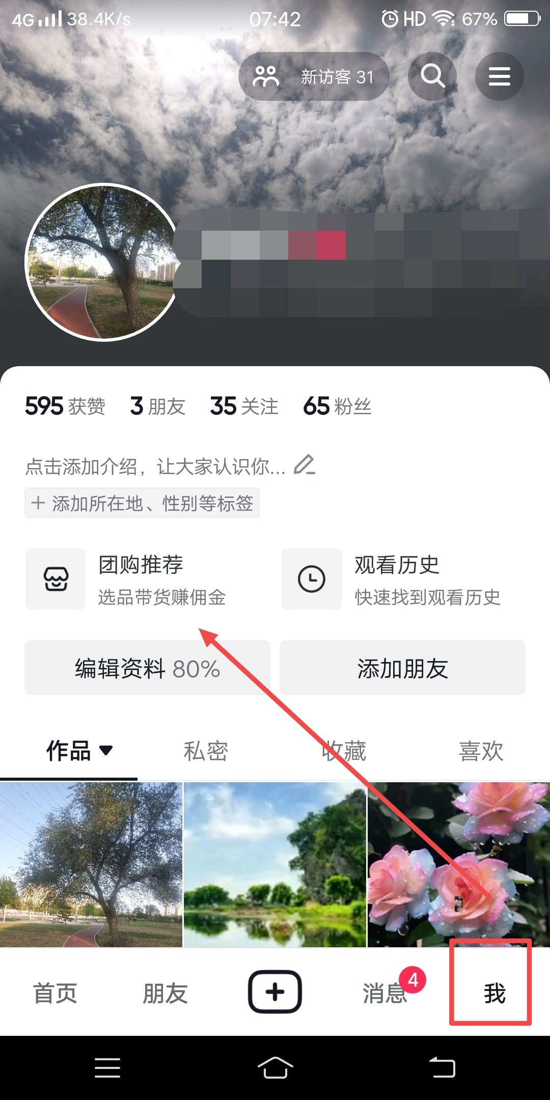 怎么轉發(fā)抖音團購鏈接？